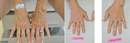 beforeandafter