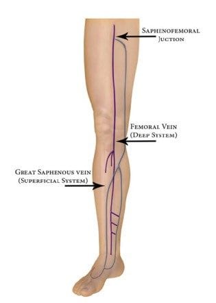 vein_pic_1