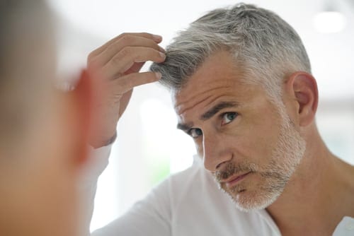 male hair restoration patient